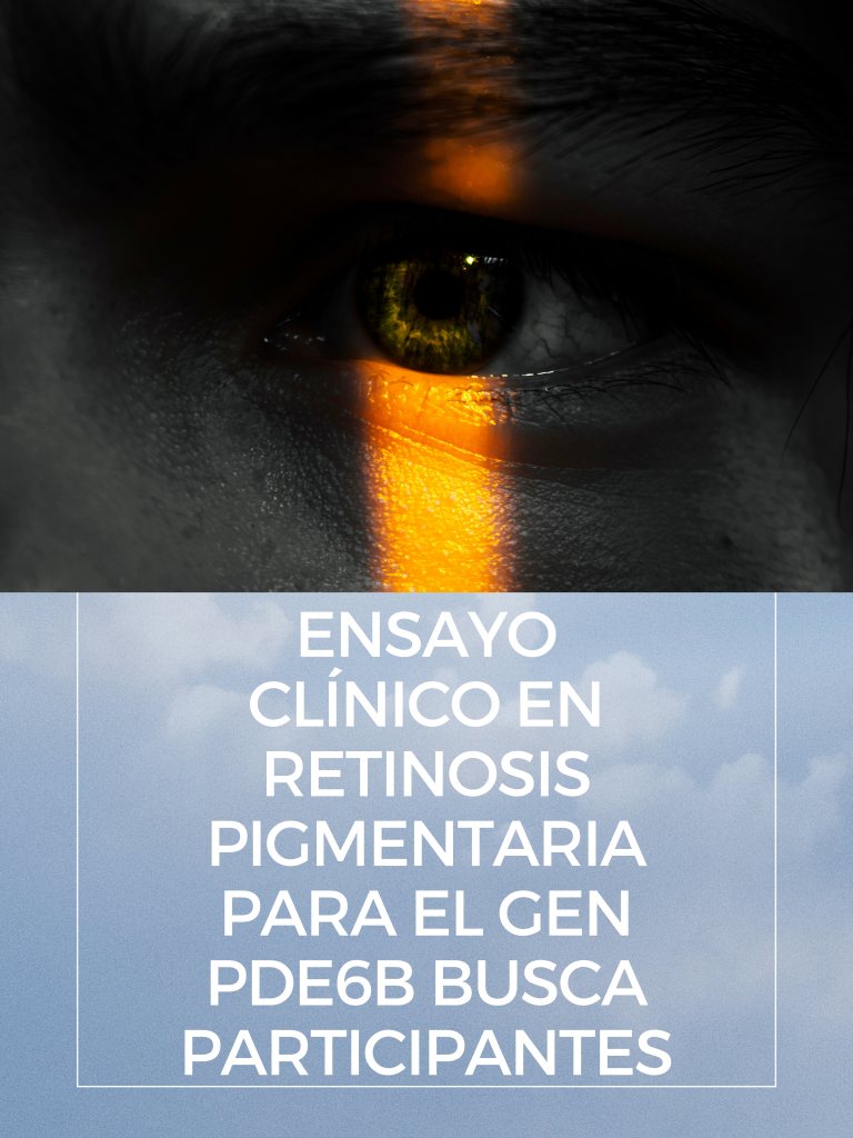 Ensayo clínico en Retinosis Pigmentaria para el gen PDE6B busca participantes